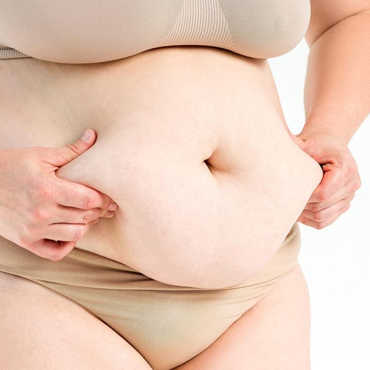 HR Plastic Sugery - Tummy pouch What Can i do